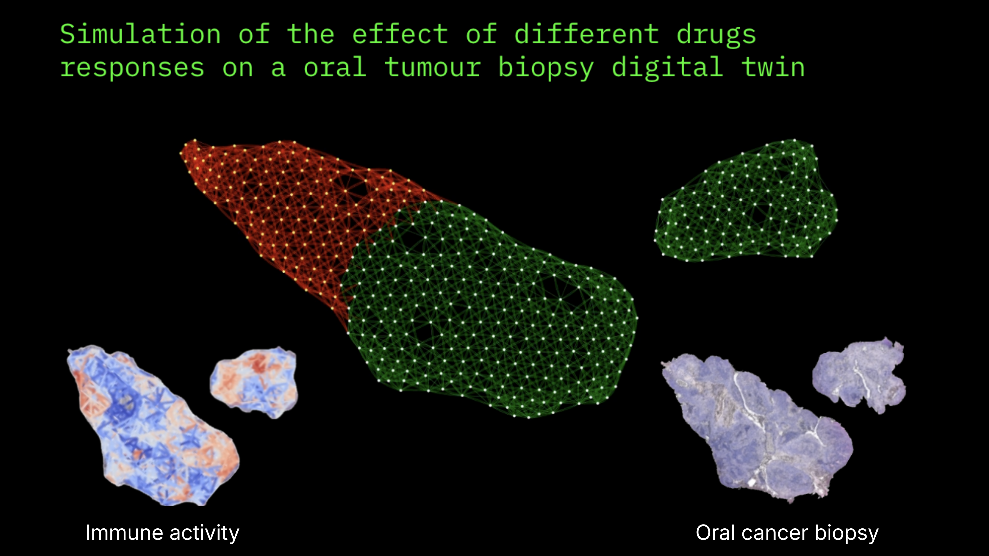 Simulation of drug effects on oral tumor biopsy digital twin showing immune activity and spatial transcriptomics